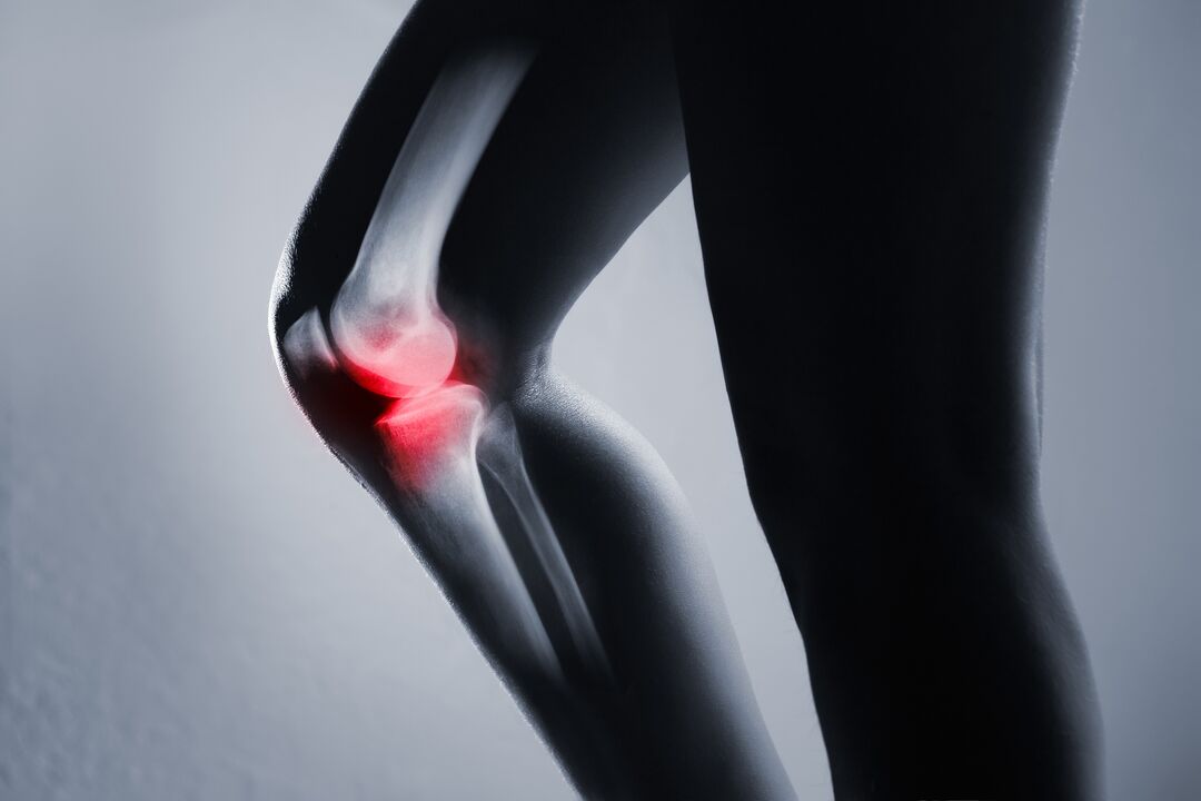zánět kolenního kloubu s artrózou