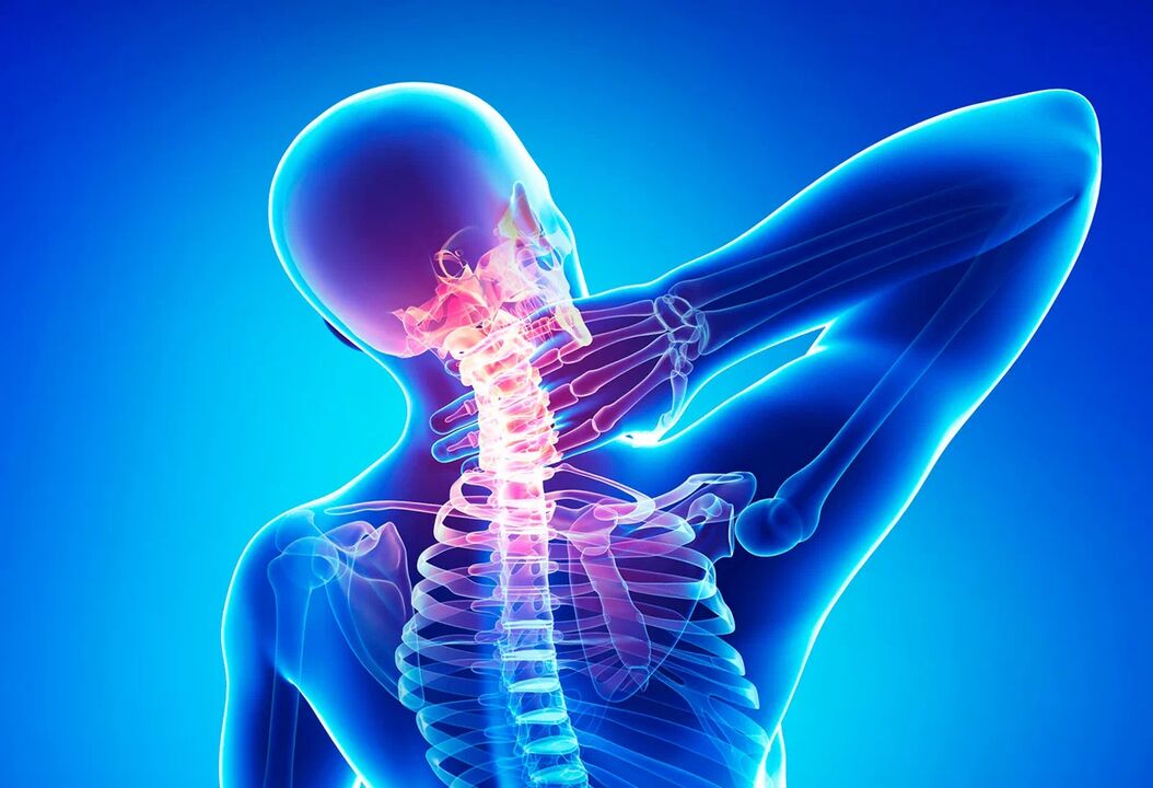 Osteochondróza páteře je běžné onemocnění, které vyžaduje léčbu. 