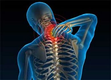 Bolest v krku je běžným příznakem osteochondrosy